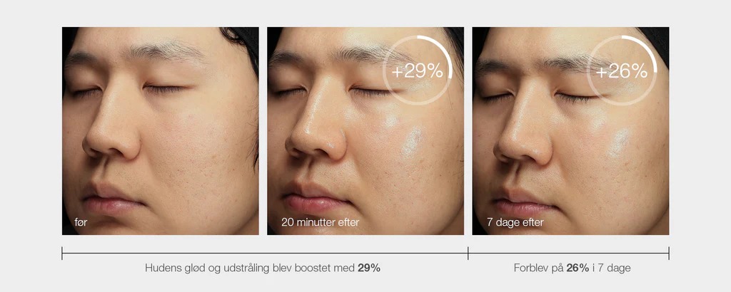 Klinisk studie; på 30 personer – se billeder ovenfor!